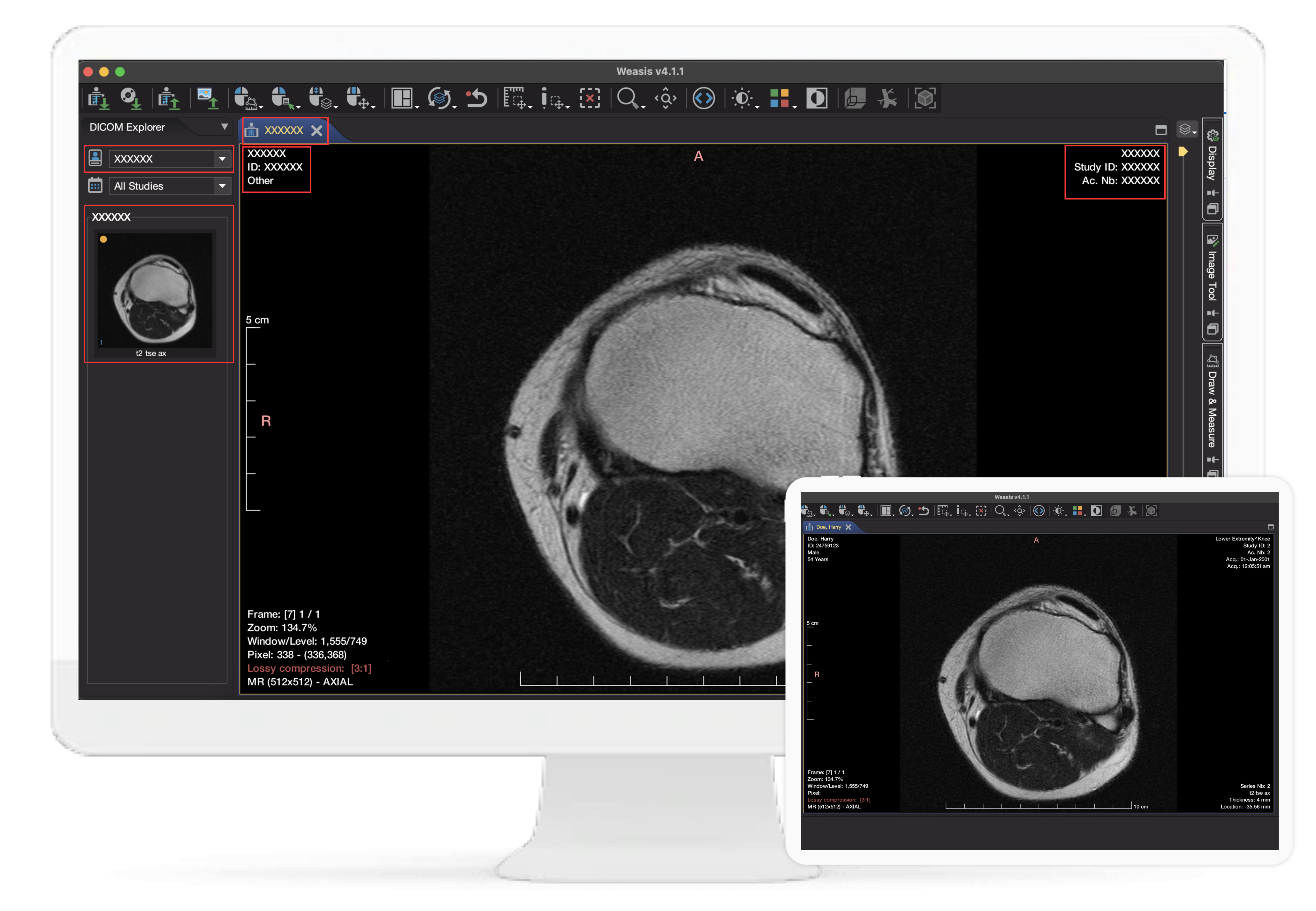 Read more about the article Transforming DICOM Data Management with clinDICOM AI: Redaction and Compliance Excellence